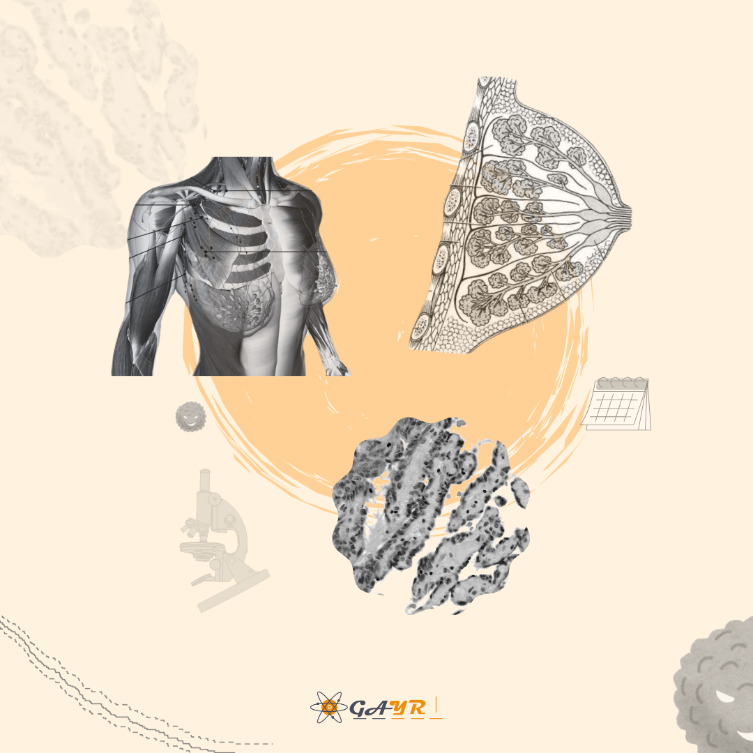 Retrospective study on postoperative adjuvant radiotherapy in primary malignant angiosarcoma of the breast patients following mastectomy or breast-conserving surgery using SEER database