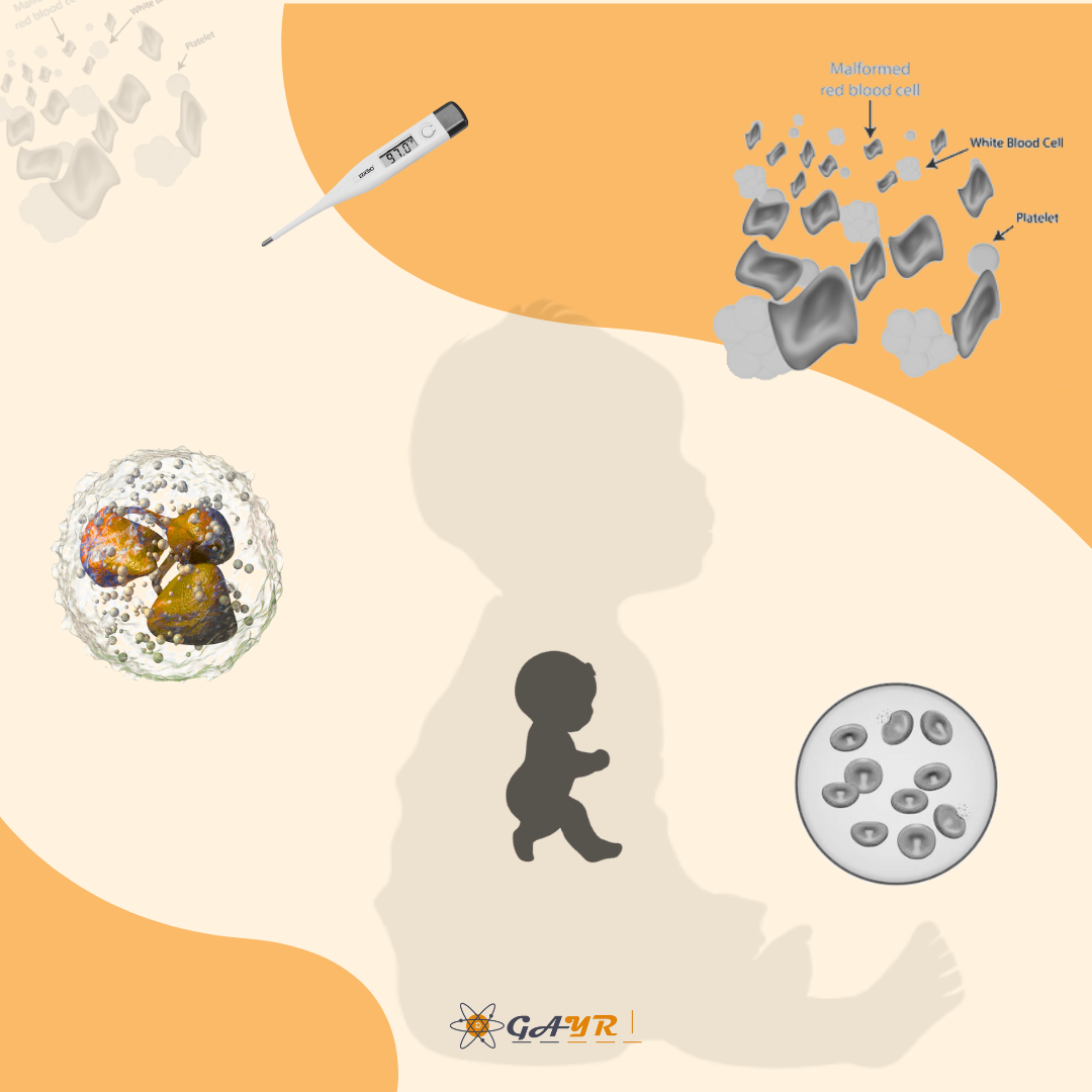 Post‐COVID‐19 Neutropenia in an Infant With Thalassemia Minor: Case Report